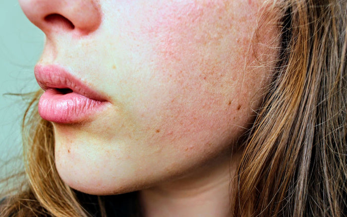 Close-up of natural facial skin texture on warm-toned brown skin