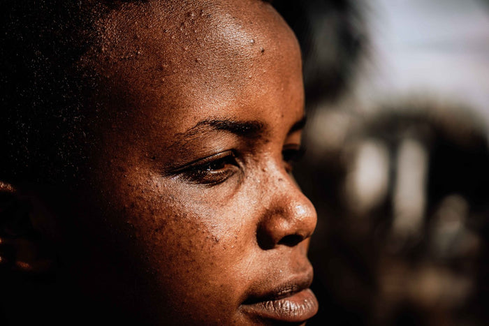 Side profile of a woman showing natural skin texture and tone