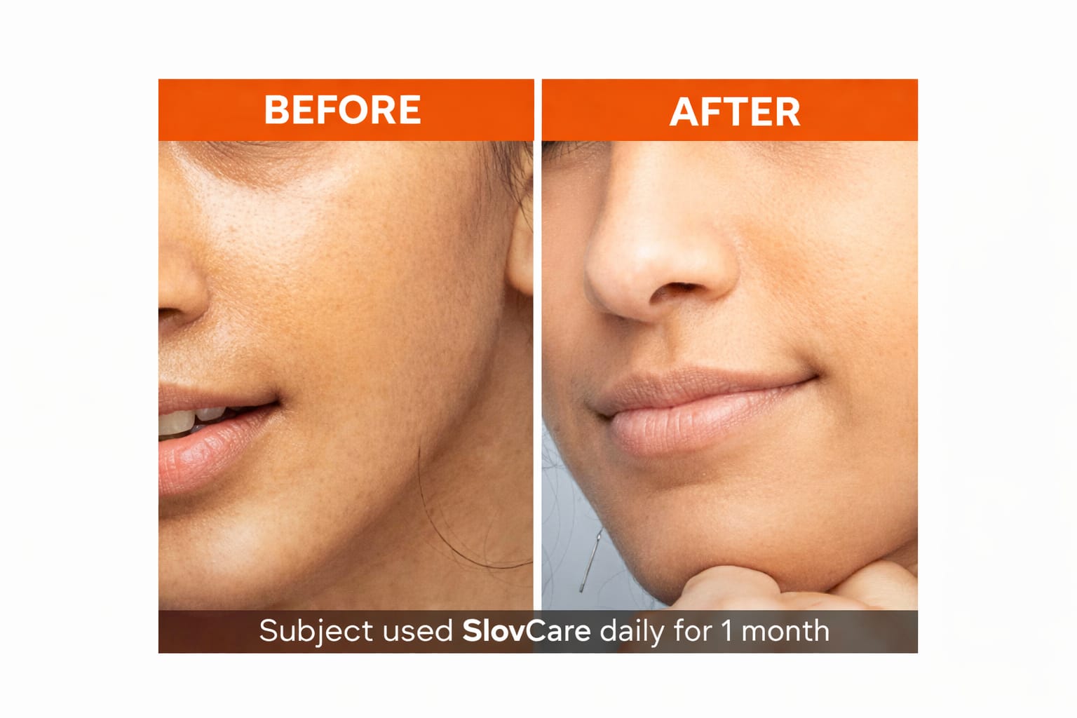 Skincare Bundles